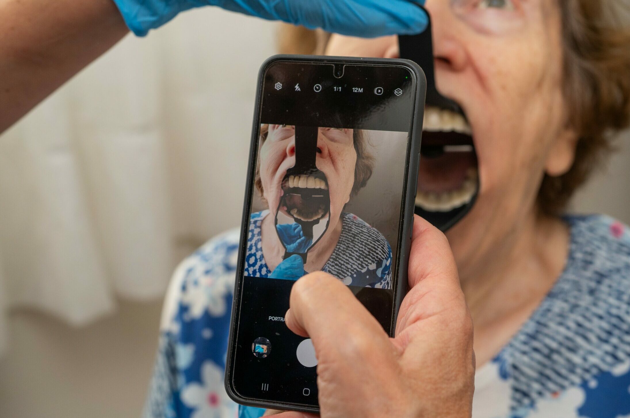 Photo intraorale avec smartphone et Odontoscope® Soignant prenant une photo intraorale avec un smartphone en utilisant l’Odontoscope pour la téléexpertise