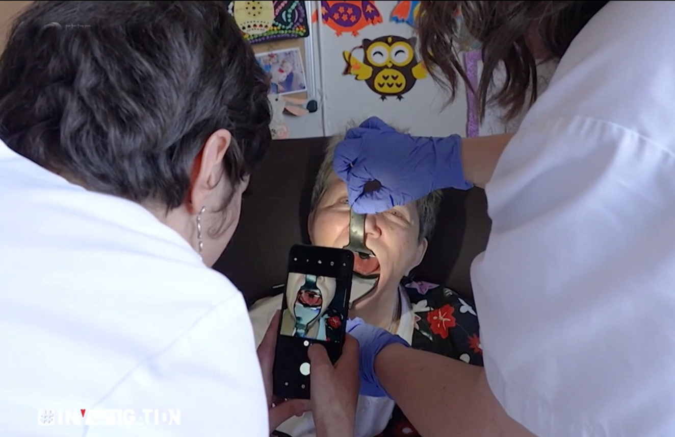 Photo intraorale avec smartphone et Odontoscope® Vue intraorale élargie de la cavité buccale obtenue avec l’Odontoscope dans un EHPAD.